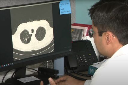 PRIPAZITE ŠTA JEDETE Rak pluća povezan je sa ishranom, evo šta hrani ćelije tumora